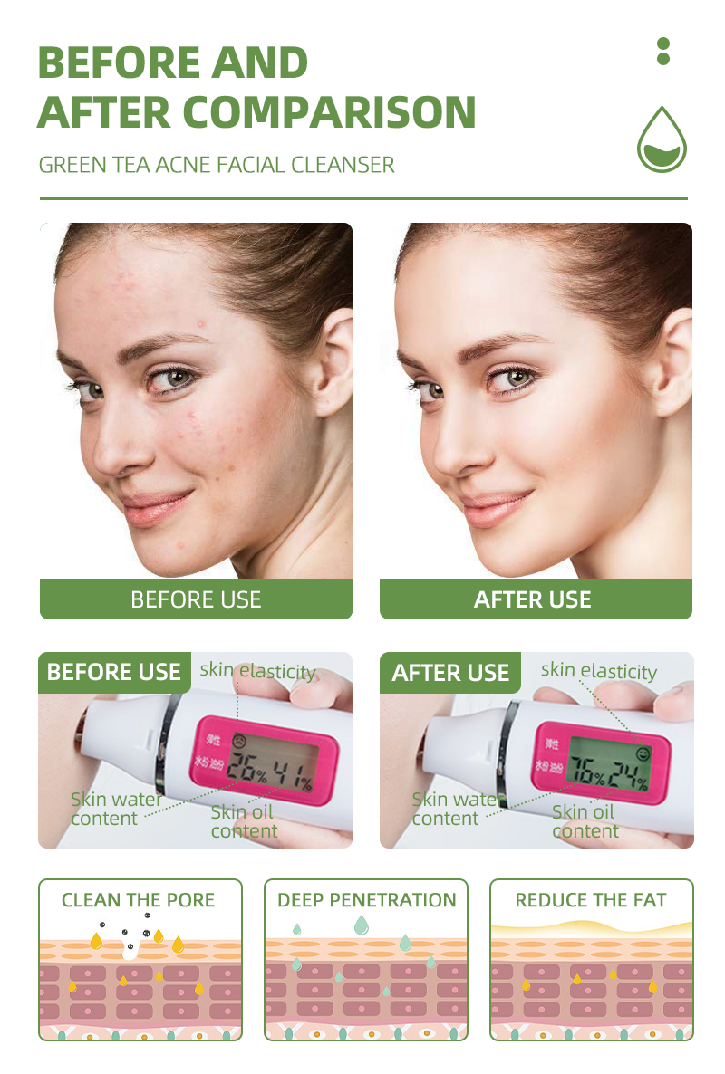 custom face cleanser,private label face cleanser,wholesale face cleanser,face cleanser manufacturer,wholesale green tea facial cleanser
