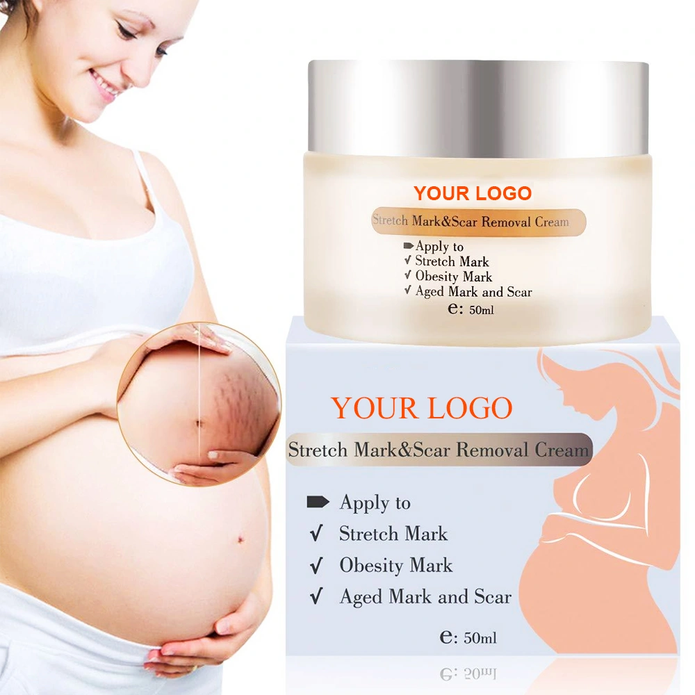 stretch mark cream;pregnancy stretch mark cream;stretch mark removal cream;anti stretch mark cream;stretch mark cream skin;private label skin cream